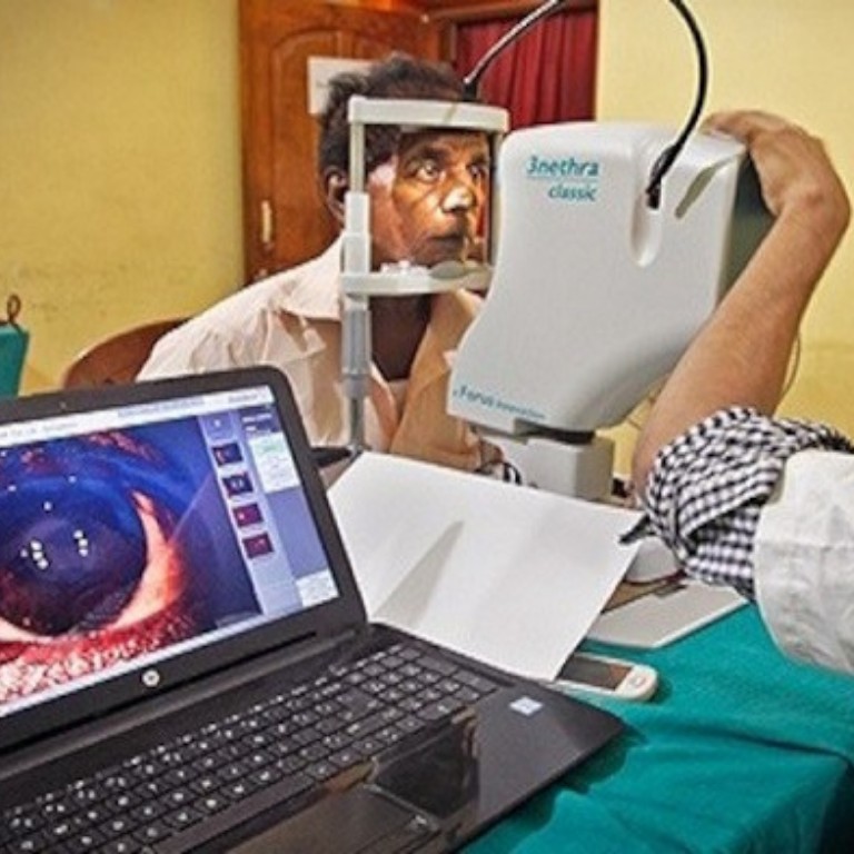 Introducing non-mydriatic fundus camera 3-Nethra.